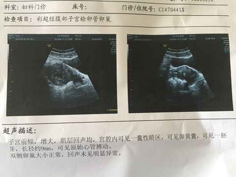 journal_insert_pic_454889483