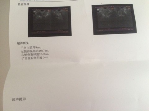 journal_insert_pic_455862659