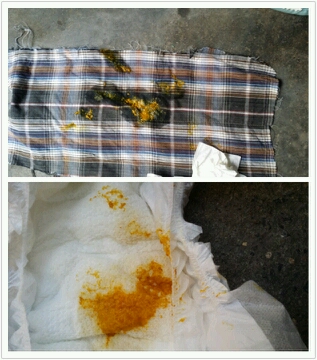 宝宝出生一个月,要打第二次乙肝疫苗,这样的便便一天差不多有7次,明天