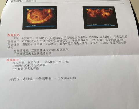journal_insert_pic_457456565