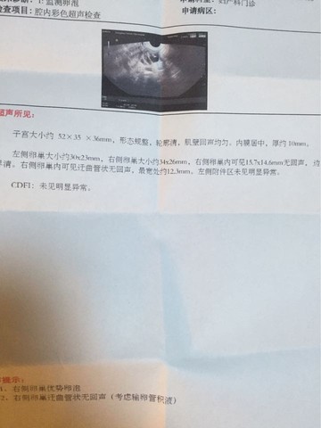 journal_insert_pic_457626154
