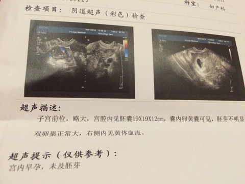 journal_insert_pic_458314073