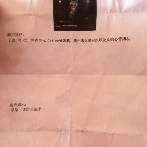journal_insert_pic_458075043
