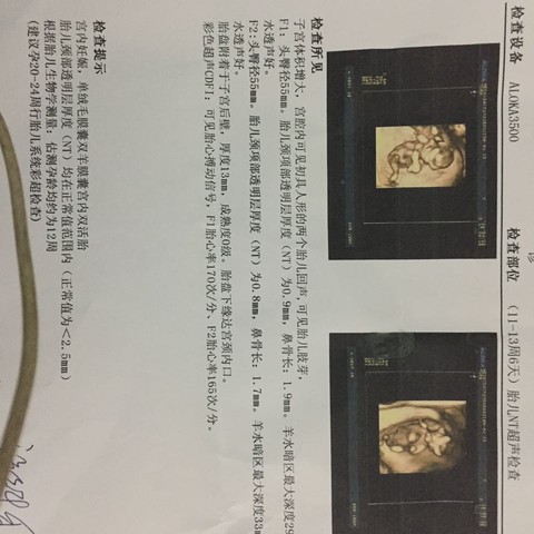 journal_insert_pic_458524146
