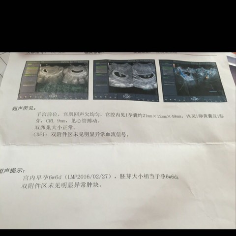 journal_insert_pic_458258939