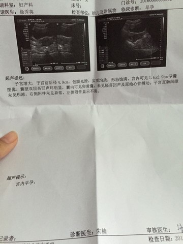 journal_insert_pic_459125686