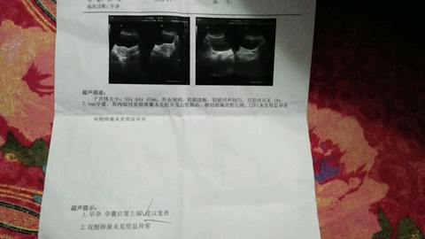 journal_insert_pic_462620885