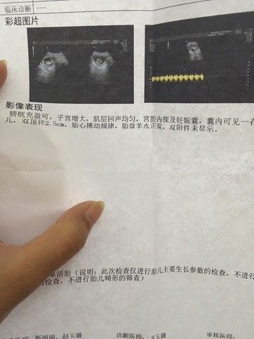 journal_insert_pic_464097602