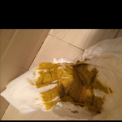 宝宝今天啦的便便比平时啦的颜色要深些.,深黄色的.