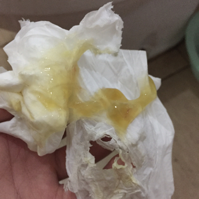 刚上厕所滴出来白带,好像有血怎麼回事是见红了吗