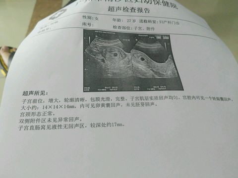 journal_insert_pic_468346241