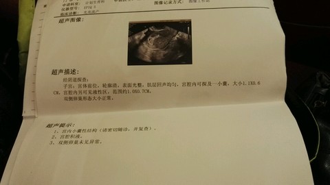 journal_insert_pic_468677537