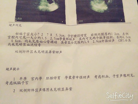 journal_insert_pic_469435947
