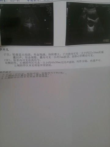 journal_insert_pic_470097529