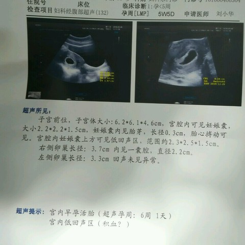 journal_insert_pic_471158883