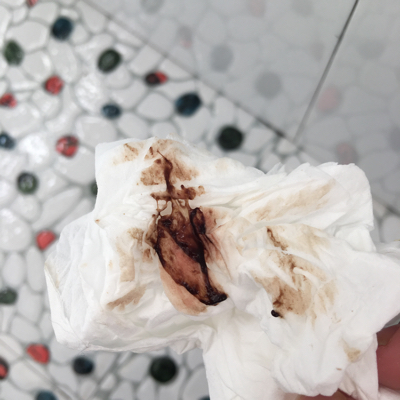 这个月不知道哪天排卵 这两天内裤上有一点褐色血迹 用纸擦没有 刚刚