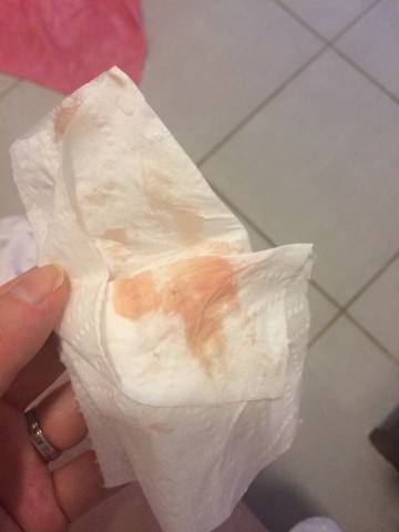孕28周阴道少量出粉红色的血_宝宝树 孕28周阴道少量出粉红色的血_宝宝树