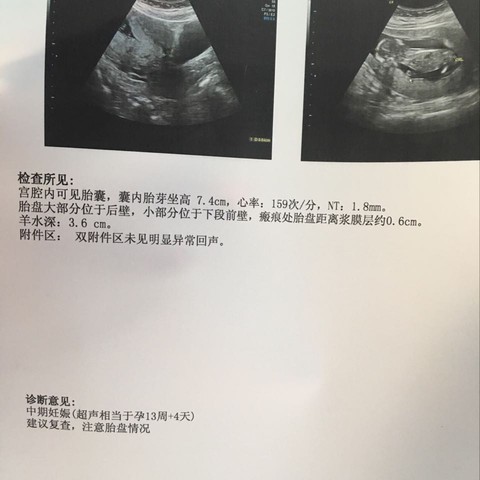 journal_insert_pic_472898846