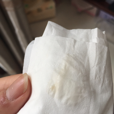 这是褐色白带还是黄色白带!