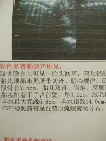 journal_insert_pic_480540472