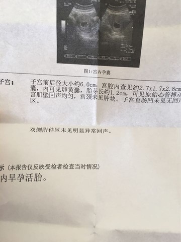 journal_insert_pic_480072614