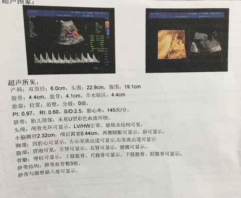 journal_insert_pic_480051028