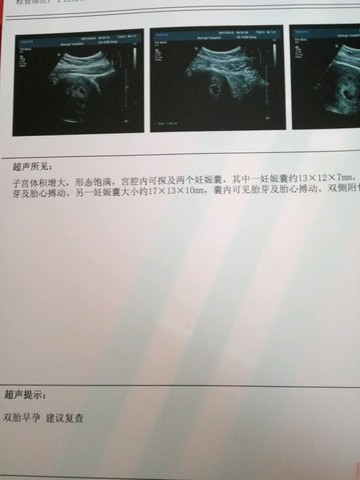 journal_insert_pic_480870562