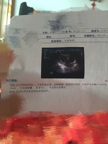 journal_insert_pic_483032648