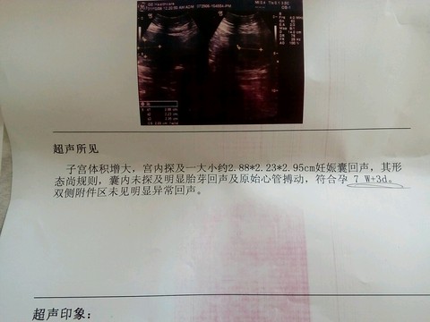 journal_insert_pic_484708698