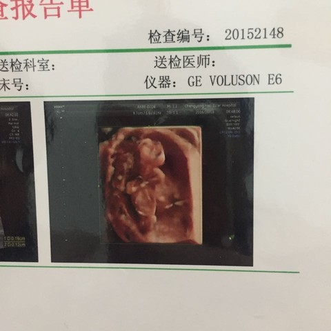 journal_insert_pic_484375438