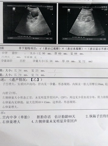 journal_insert_pic_485934167