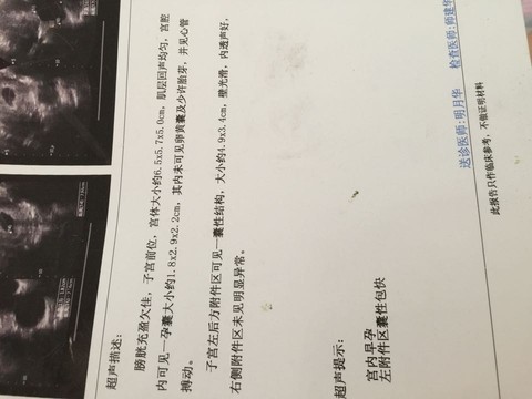 journal_insert_pic_485575281