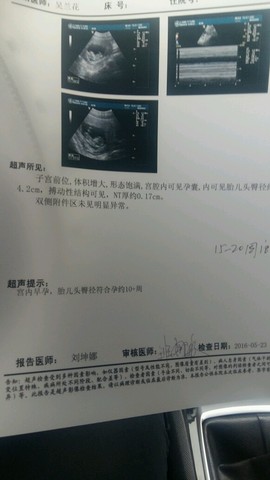 journal_insert_pic_486659217