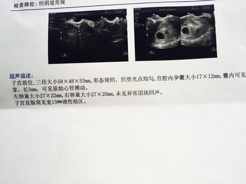 journal_insert_pic_486308585