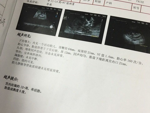 journal_insert_pic_487557777