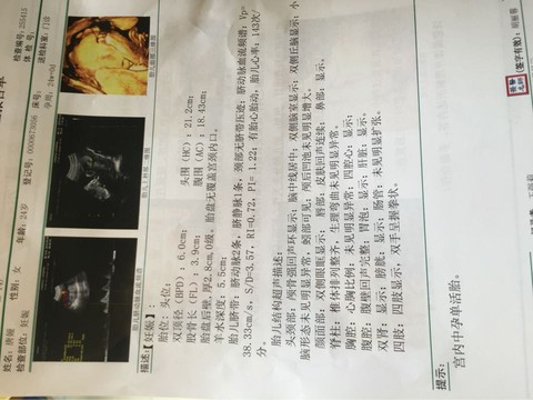 journal_insert_pic_487730859