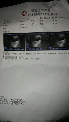 journal_insert_pic_490045889