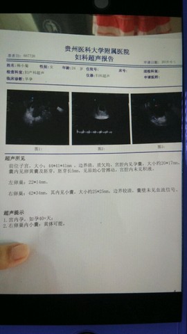 journal_insert_pic_495292661