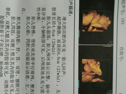 journal_insert_pic_496057679
