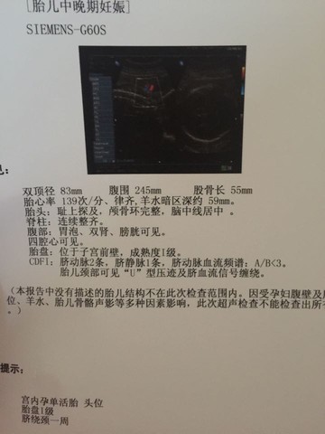 journal_insert_pic_497084827