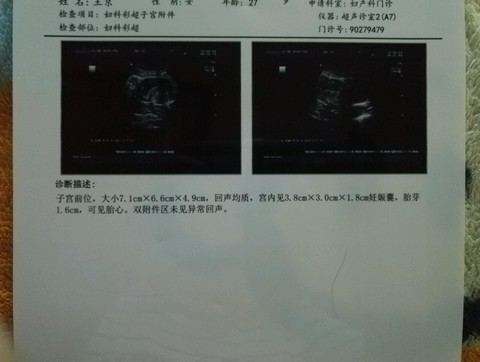 journal_insert_pic_497048076