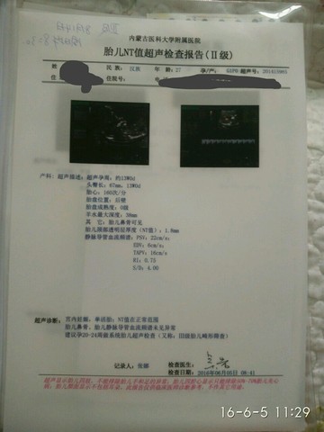 journal_insert_pic_498591341