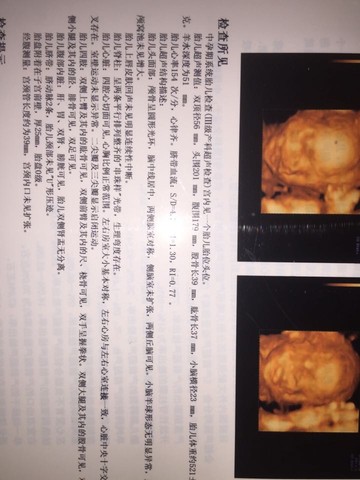 journal_insert_pic_499102867
