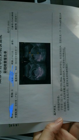 journal_insert_pic_500580397