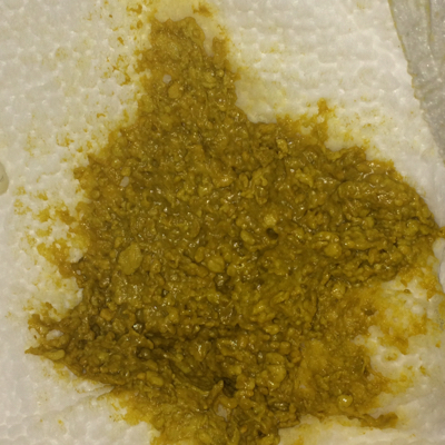 混合喂养,但是奶水不是特别多,这样的便便是不是有些消化不良呢?