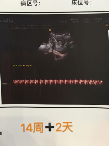 journal_insert_pic_502215724