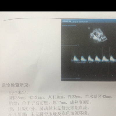 现在孕16周 15周出现一次出血 暗红 去看急诊吃了保胎药 16周又一次出血 暗红 两次都是不知道什么原因 现在又担心又害怕 宝宝树