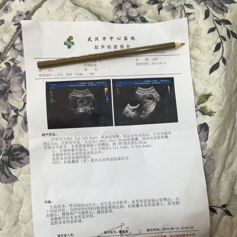 journal_insert_pic_504347818