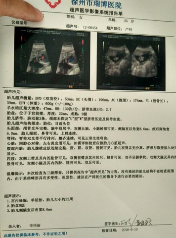 journal_insert_pic_504050476