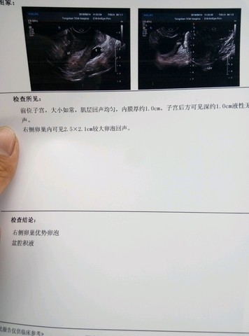 journal_insert_pic_506615192